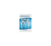 Handbook Of Hip And Knee Joint Replacement