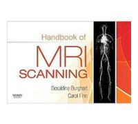 Handbook of MRI Scanning Carol Ann Finn, Geraldine Burghart (Auteur)