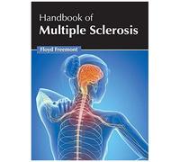 Handbook Of Multiple Sclerosis