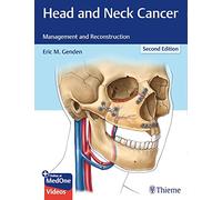 Head and Neck Cancer: Management and Reconstruction