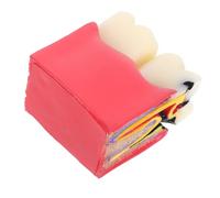 Healifty Modèle Pédagogique D’Anatomie Carie X6 en Résine Modèle Comparatif Dents Saines Vs Cariées Outil Éducatif pour Étudiants Dentistes et Prévention Bucco- en Cabinet et École