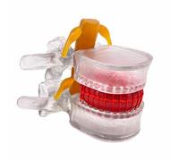 Hellery Modèle Colonne Vertébrale Articulé | Agrandie 1,5 Fois, Modèle Colonne Lombaire Nerfs Spinaux, Monté sur Support, Maqute Anatomique Rachis Lombaire, Transparent