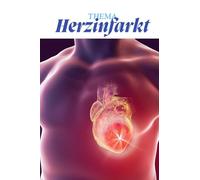Herzinfarkt kompakt - Pflegewissen für Auszubildende: Alles, was du wissen musst: Symptome, Diagnostik, Behandlung, Prävention & Übungen