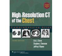 High-Resolution CT of the Chest: Comprehensive Atlas