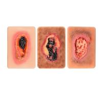 HiJiuAn Dispositif De Simulation De Pansement par Granulation (3 Ou 4 Pièces), Modèle De Pansement De La Taille d'une Paume, pour La Formation Médicale Et Les Démonstrations De Soins des Plaies