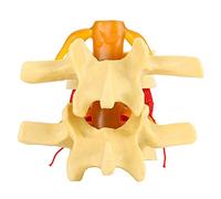 Hilitand Modèle de Démonstration de Hernie Discale Lombaire Humaine Colonne Vertébrale Humaine Médicale pour Étude, Modèle Anatomique de Démonstration, Taille 1: 1,5