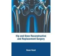 Hip And Knee Reconstructive And Replacement Surgery