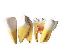HIRNER Modèle Modèle d'enseignement modèle de Dents réaliste pour l'enseignement du Nettoyage buccal modèle Dentaire école Maison éducation précoce modèle d'aide au brossage pour enseigner