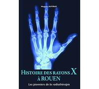 Histoire des rayons X à Rouen: Les pionniers de la radiothérapie