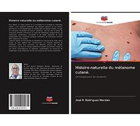 Histoire naturelle du mélanome cutané.: Oncologie pour les étudiants.