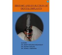HISTORY AND EVOLUTION OF DENTAL IMPLANTS