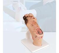 HKFGSHOP Modèle De Pied Diabétique, Lésions Purulentes De La Plaie (maladie Légère De Niveau 1 À 3 Ou Grave De Niveau 4 À 5), Simulateur De Pied Diabétique avec Plaque Graduée, Outil De Démonstration