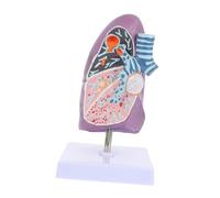 Holibanna Modèle Anatomique Pulmonaire Pathologique Du Fumeur pour Enseignement et Pratique Outil Pédagogique Visuel pour Étudiants et de