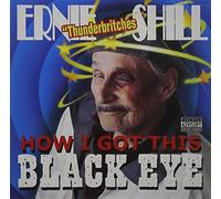 How I Got This Black Eye