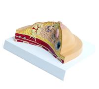 HPTHLY Modèle Humain Modèle Anatomique du Sein Féminin, Anatomie Maladie Cancer Modèle Pathologique du Sein, Modèle Anatomique en Coupe Transversale du Sein Pathologique Modèle Squelette