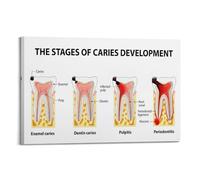 HSMXNEONJB Understanding Tooth Decay Poster - Visual Guide to Dental Caries Development Stages, Educational Wall Decor for Clinic(Framed,08x12inch(20x30cm))