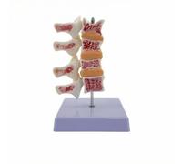 HuadaXtai Modèle Squelte Vertébral Lombaire | Texture Osseuse Interne Détaillée, Compact, pr Formation Médicale