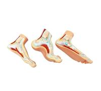 HUIBBGO Modèle de Pied Humain, Modèle d'anatomie Musculaire du Pied (3 éléments), Modèle de podologie du Pied Humain, Anatomie Normale du Pied, Pied Plat et Pied à dépôt Important
