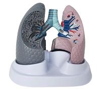 HUIBBGO Modèles pédagogiques pour l'étude : modèles de poumons sains et Fumeurs, modèle d'anatomie pulmonaire Humaine, modèles pédagogiques en pathologie et biologie, Outils pédagogiques m