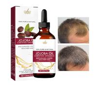 Huile de jojoba dense, huile de croissance des cheveux anti-frisottis pour la croissance des cheveux, huile naturelle anti-frisottis 30 ml pour cheveux secs, abîmés et croissance