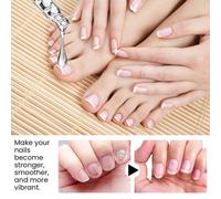 Huile De Soin Pour Ongles Fortifiante Et Réparatrice Pour Cuticules, Onychomycose, Épaississement Doux Des Ongles, Hydratante Et Brillante - Saveur Arbre À Thé 15 Ml