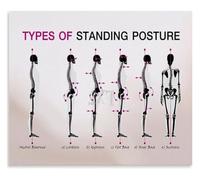 HUJWLBWF Standing Posture Mistakes and Spine Disorders Poster Ergonomic Tips for Desk Workers Home Office Decor(Framed,08x12inch(20x30cm))