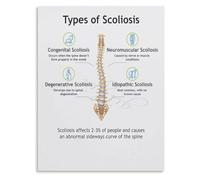 Human Spine Scoliosis Types Poster Curve Classification Education Chart Anatomy Learning Tool for Clinic Office(Unframed,16x24inch(40x60cm))