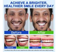 Hydroxyapatite Toothpaste,7.5% Hydroxyapatite,Fluorine Free,Mint Flavour-Whitens Smooth,Freshens Breath,Strengthens Teeth Structure,Prevents Caries 4.23oz (120g)