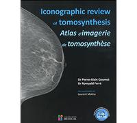 ICONOGRAPHIC REVIEW OF TOMOSYNTHESIS. ATLAS D IMAGERIE DE TOMOSYNTHESE