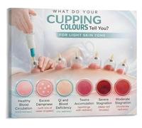 IDGTTLDF Cupping Skin Reaction Poster Chart Clinical Use | Helps practitioners distinguish between therapeutic petechiae and adverse skin responses after(Framed,12x18inch(30x45cm))