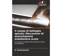Il campo di battaglia apicale: Meccanismi di esacerbazione endodontica acuta: Una revisione completa della letteratura sul flare-up endodontico