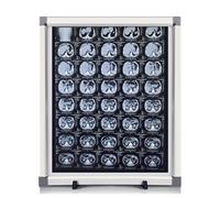 Illuminateur LED Professionnel à Rayons X, Équipement De Laboratoire, Cadre En Aluminium Ultra-fin avec Crochet, for Clinique et Hôpital(Small)