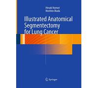 Illustrated Anatomical Segmentectomy for Lung Cancer