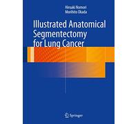 Illustrated Anatomical Segmentectomy for Lung Cancer