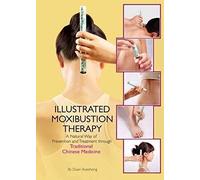Illustrated Moxibustion Therapy: A Natural Way Of Prevention And Treatment Through Traditional Chinese Medicine