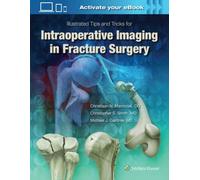 Illustrated Tips And Tricks For Intraoperative Imaging In Fracture Surgery