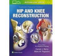 Illustrated Tips And Tricks In Hip And Knee Reconstructive And Replacement Surgery