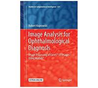 Image Analysis For Ophthalmological Diagnosis : Image Processing Of Corvis® St Images Using Matlab®