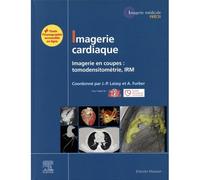 Imagerie cardiaque Imagerie en coupes : scanner, IRM - LAISSY-J-P/FURBER-A/SFC/S - Elsevier Masson - cartonné - Scolaire / Universitaire