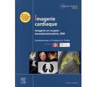Imagerie cardiaque: Imagerie en coupes : scanner, IRM