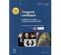 Imagerie cardiaque Jean-Pierre Laissy (Auteur), Professeur Alain Furber (Auteur), Société Française de Cardiologie (SFC) (Auteur), Société Française de Radiologie (Auteur)