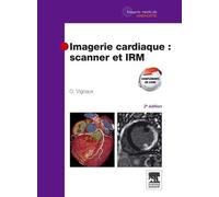 Imagerie Cardiaque : Scanner Et Irm
