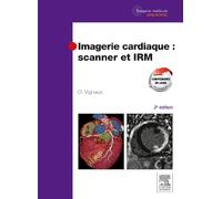 Imagerie cardiaque : scanner et IRM