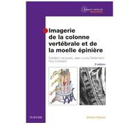 Imagerie de la colonne vertébrale et de la moelle épinière 3ème édition - Frédéric Lecouvet - Elsevier Masson - broché - Scolaire / Universitaire