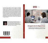 Imagerie de la Déglutition: Analyse de la physiologie de la déglutition et des dysphagies oropharyngées par ciné-IRM