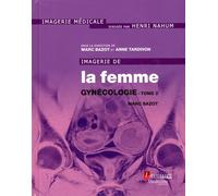 Imagerie De La Femme : Gynécologie - Tome 2