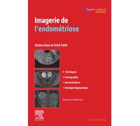 Imagerie de l'endométriose - Rasha Alani - Elsevier Masson - ebook (ePub) - Scolaire / Universitaire