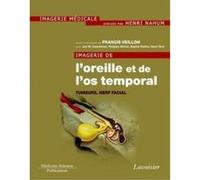 Imagerie De L'Oreille Et De L'Os Temporal T,4 , Tumeurs, Nerf Facial Veillon, Francis (Auteur)