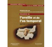 Imagerie de l'oreille et de l'os temporal - Volume 1. Anatomie et imagerie normales: Volume 1. Anatomie et imagerie normales