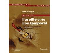 Imagerie de l'oreille et de l'os temporal - Volume 3. Traumatologie, urgences, otospongiose: Volume 3. Traumatologie, urgences, otospongiose
